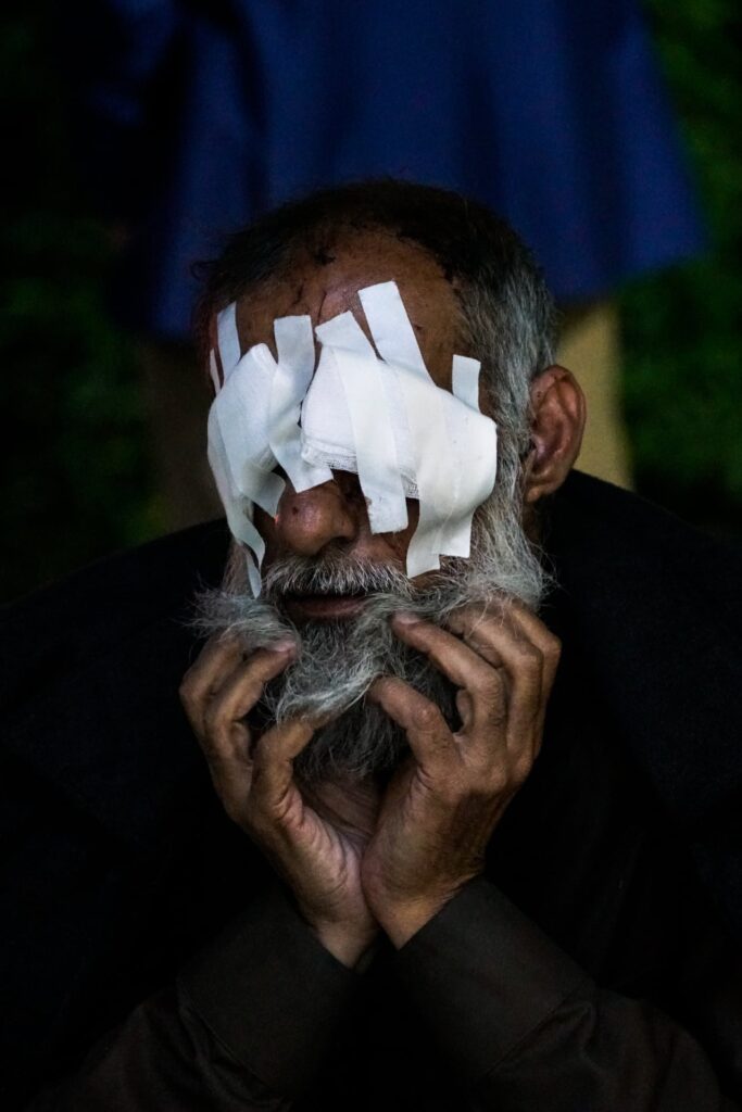 Adnan Thanon Younis was blinded by an exploding shell in Mosul, Erbil, Iraq, 2017