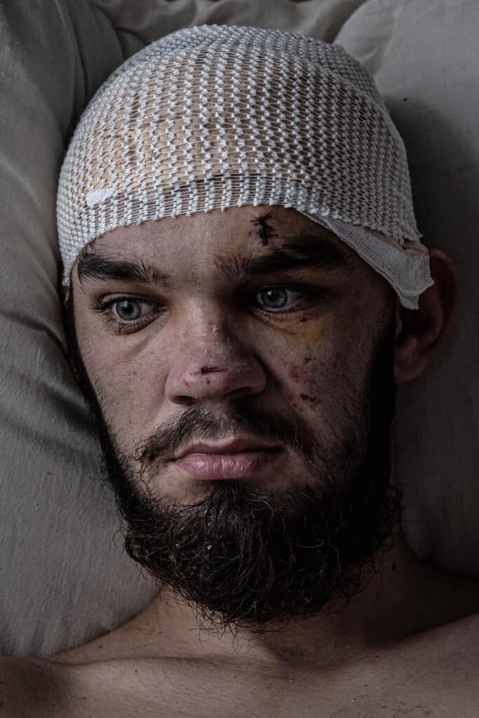 Ukrainian soldier Artem Guz, 25, who was unable to speak or move his right arm and leg due to blast injuries caused by Russian shelling, lies in a bed at the Mechnikov Hospital in Ukraine’s eastern city of Dnipro, January 18, 2024. © Finbarr O’Reilly for The New York Times