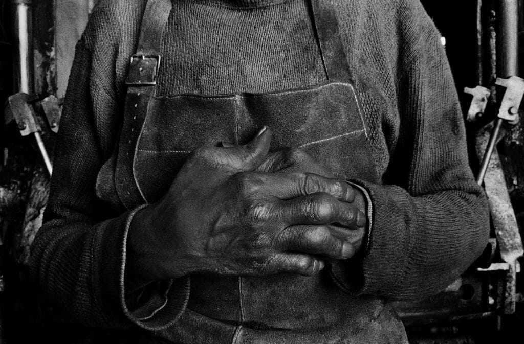 Moulder, 29 years, industrial accident, Oakland, California 1975 © Ken Light / Contact Press images